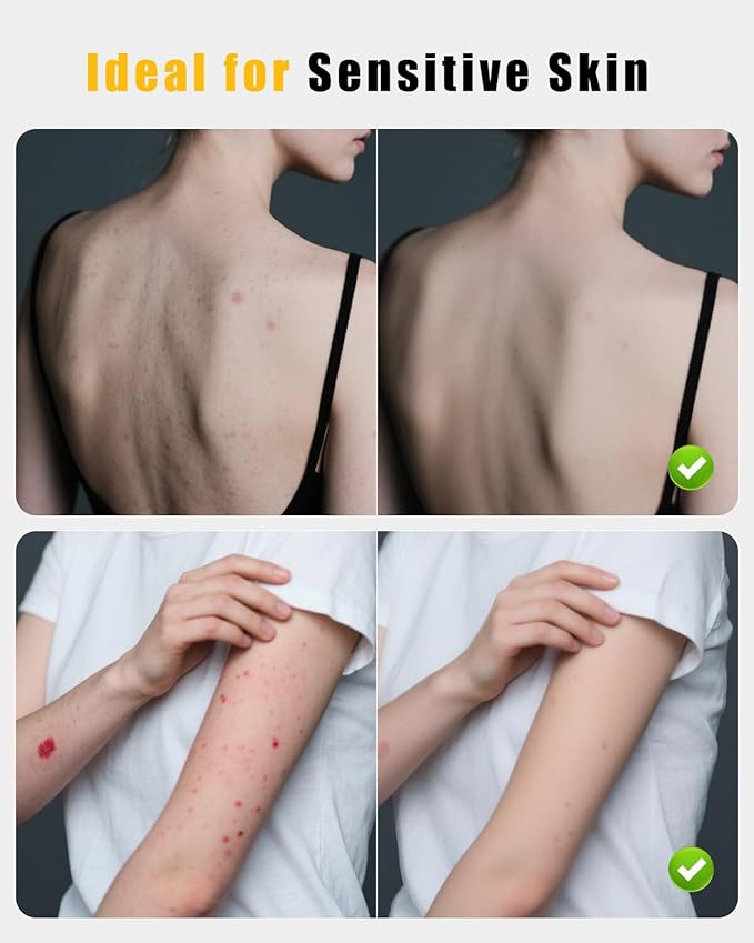 2 in 1 Silicone Body Scrubber, Anti Cellulite Massage Scrubber, Exfoliating Shower Brush for Men & Women, Removes Dead Skin, Reduces Cellulite, Improves Circulation, Fast Dry, Non Slip (1PC, Black)