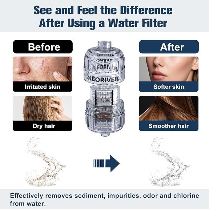 High Output Revitalizing Shower Filter - Reduces Dry Itchy Skin, Dandruff, Eczema, Softens Hard Water and Dramatically Improves The Condition of Your Skin, Hair and Nails