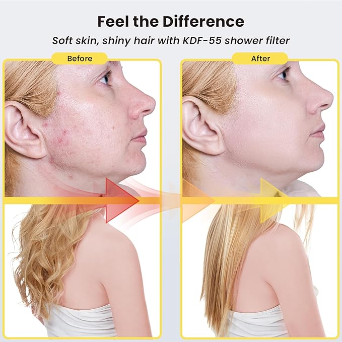 Ryamen Filtered Shower head, Rain Shower Head with Filter, High Pressure Shower Filter Head for Hard Water, 99% REMOVAL for Chlorine, Heavy Metals, Improves Skin & Hair, Brushed Nickel