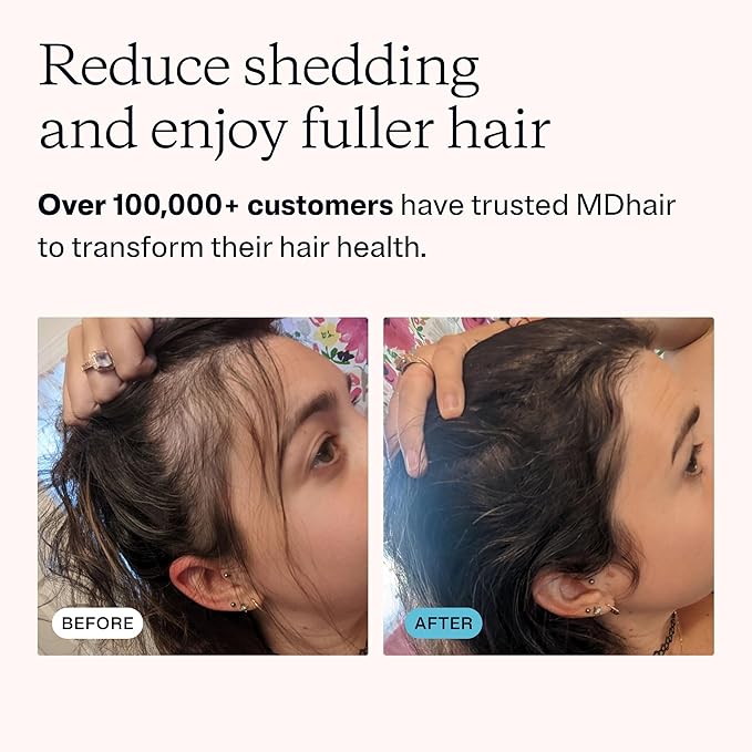 Filtered Shower Head for Healthier Hair & Skin – Removes Chlorine & Heavy Metals, High Pressure Shower Head Filter for Hard Water, Dermatologist-Formulated Water Softener for Hard Water