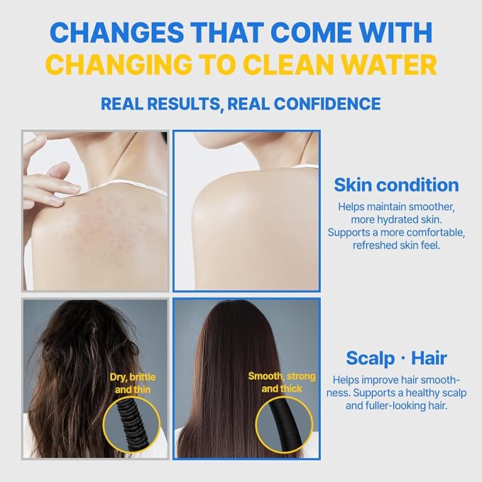 Filter Shower For K-Beauty Skin Care– Pure Carbon Filters for Softer Skin & Smoother Hair | Carbon Composite Filter l 6 Month Advanced Filtration Set (AJ8200MC-SET-6MO)