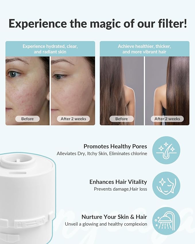 Filtered Shower Head for Hard Water, KDF-55 Filter Dermatologist Recommended for Softening Hard Water, Advanced Filtration for Hair and Skin (CP)